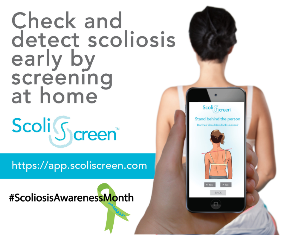 check for scoliosis at home
