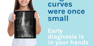 scoliosis progression