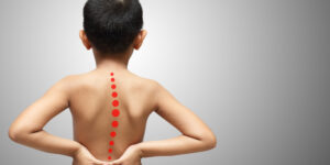 scoliosis kid treatment